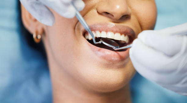 Best Emergency Tooth Extraction in Hernando, MS