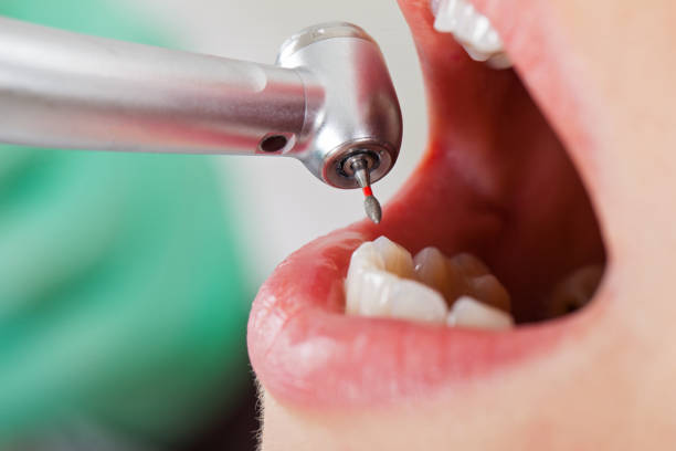 Best Urgent Care for Lost Fillings or Crowns in Hernando, MS